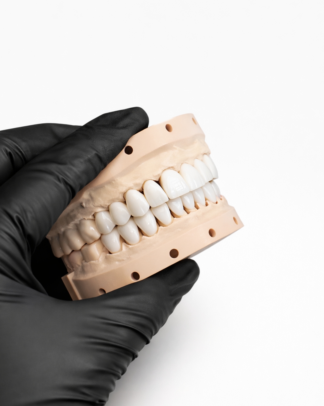 E.max Veneer  -  product